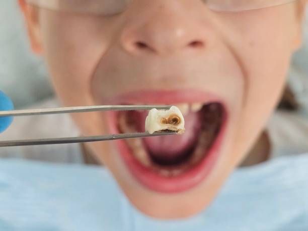 Best Emergency Broken Tooth Repair in Greenville, PA